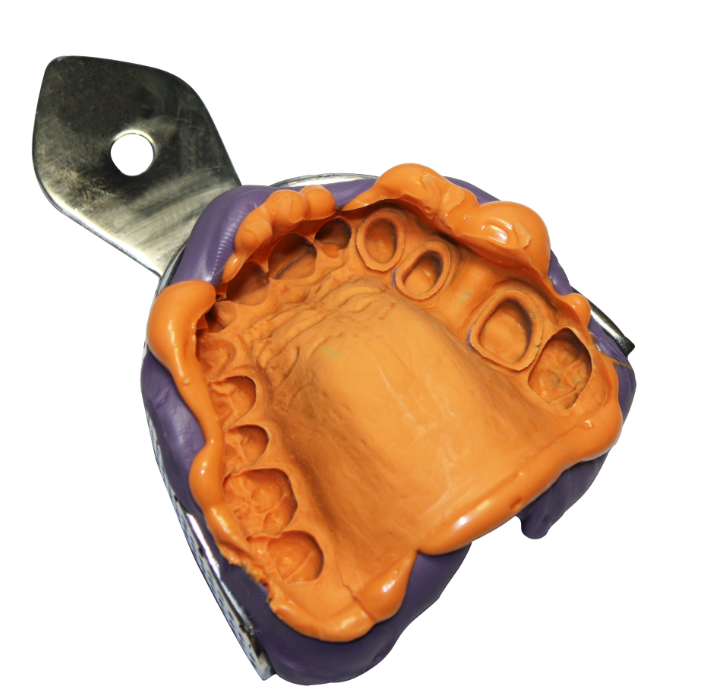 Impression Putty (10 x Pairs)