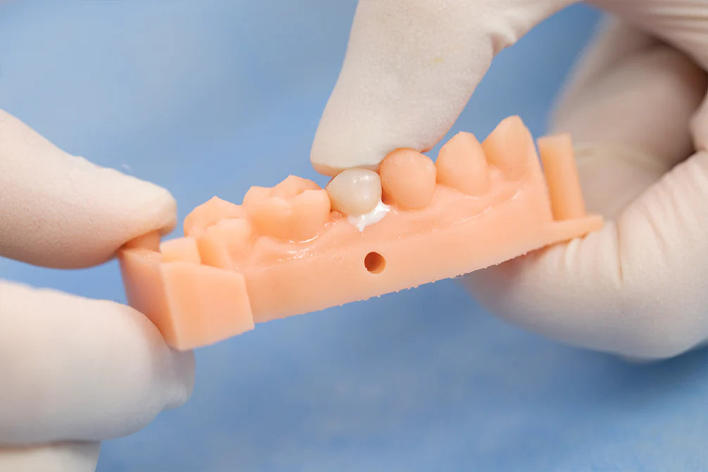 TopCEM-RMGI Resin Modified Glass Ionomer Cement-Luting