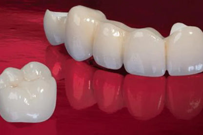 Prime Multilayer High Translucency (MHT) Zirconia Block