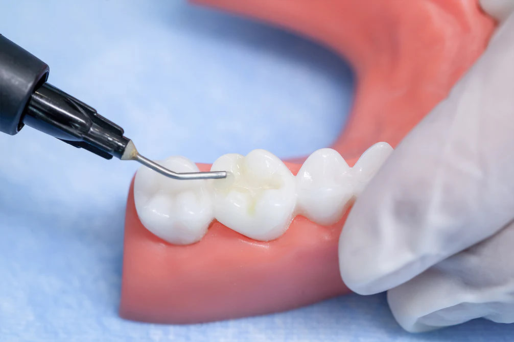 TrusFIL-Flow Flowable Composite Restorative